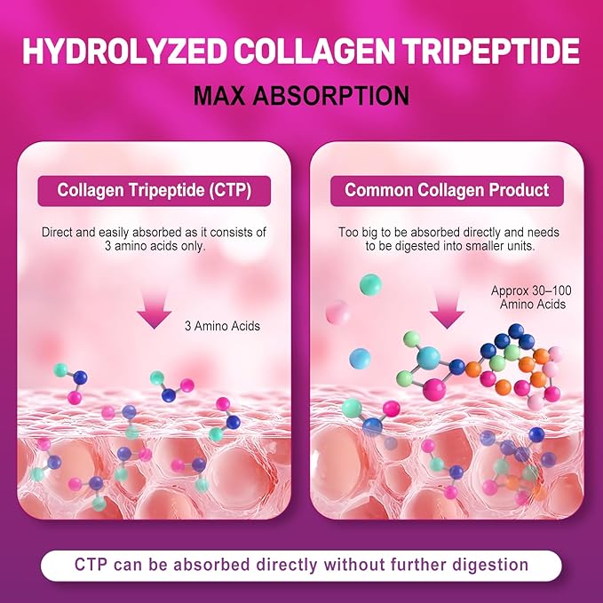 Multi Collagen Peptides Powder – Hydrolyzed Collagen Type I, II, III, V, X with Hyaluronic Acid, Vitamin C, Biotin, Supports Skin Hair Nail & Joint, Grass-Fed, Non-GMO, Unflavored, 30 Servings