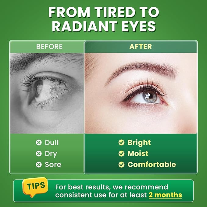 Lutein and Zeaxanthin Supplements - Advanced AREDS 2 Eye Vitamins - Bilberry Supplement for Eyes, with Astaxanthin, Ginkgo Biloba, Sodium Hyaluronate - for Eye Health & Brain Support, 60 Capsules