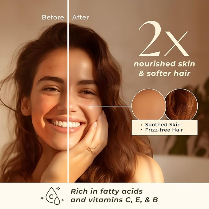 Gya Labs Organic Rosehip Oil for Face - 100% Pure Natural Vegan Rosehip Seed Carrier Oil for Skin, Hair & Body (1 Fl Oz)