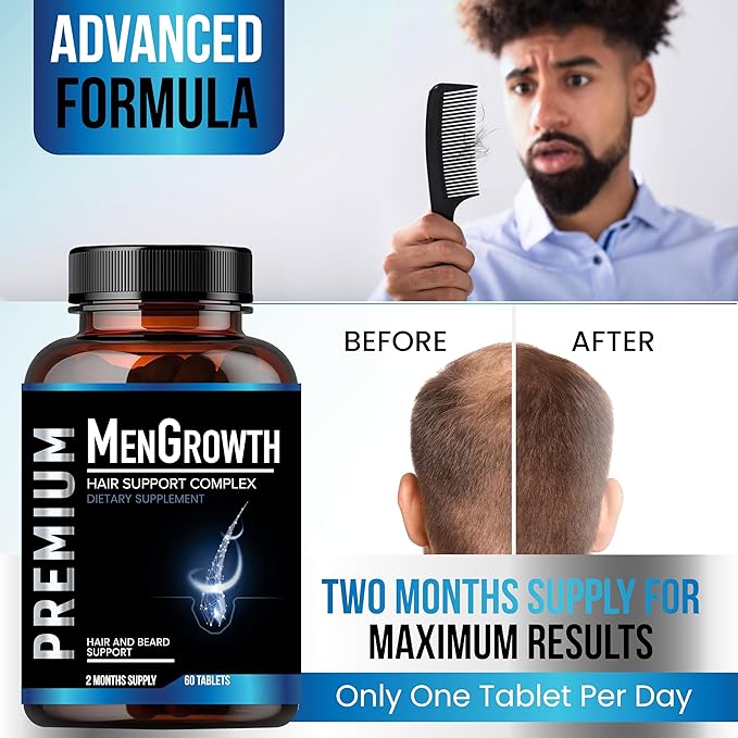 Mens Hair Growth-Hair Vitamins For Men. Anti Hair Loss Supplement, Regrow Hair & Beard Growth Pills With DHT Blocker For Thinning Hair & Hair Thickening With Biotin & Saw Palmetto.Thicker Fuller Hair
